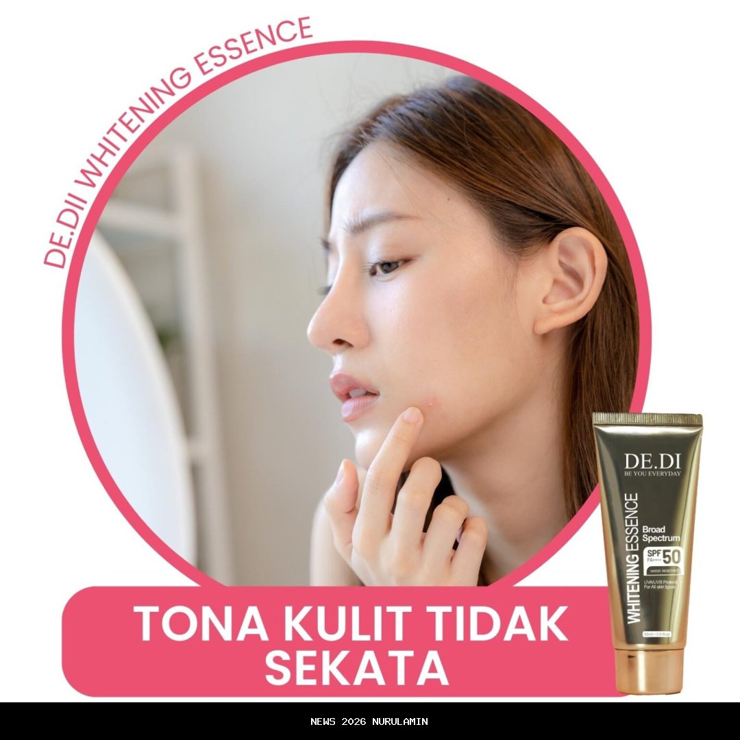 Dedi Mulyadi Larang Izin Perumahan di Bandung Raya, Ini Tanggapan Bupati Bandung Barat