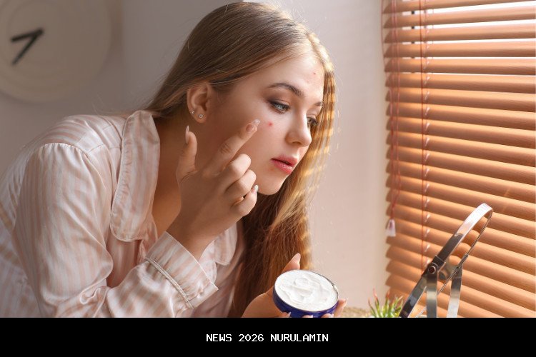 Jangan Panik! 4 Trik Ampuh Menghilangkan Kebiasaan Berjerawat